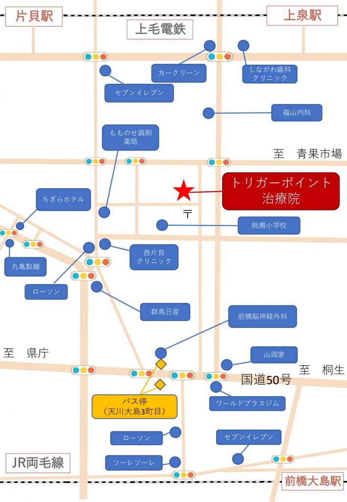 トリガーまでの地図